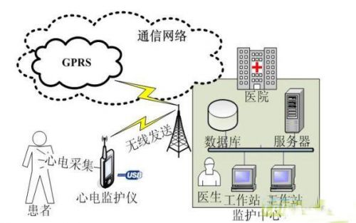 便携式心电监护系统的设计与解决方案