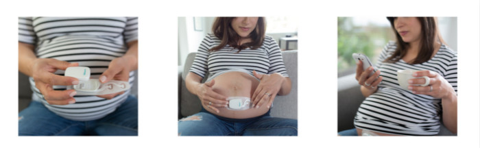 Bloomlife专注于研究孕妇产前监测和护理的医疗传感器