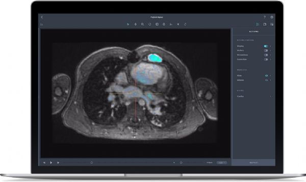 FDA批准医械公司Arterys开发的新型MRI分析软件