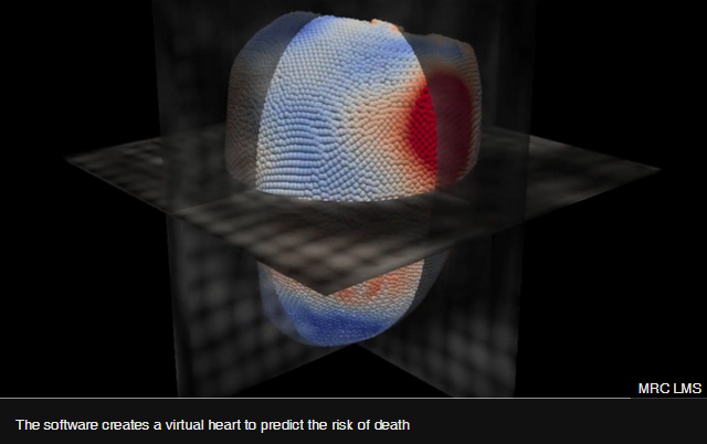 人工智能加速心脏病影像应用，或可预测心脏病患者存活时间