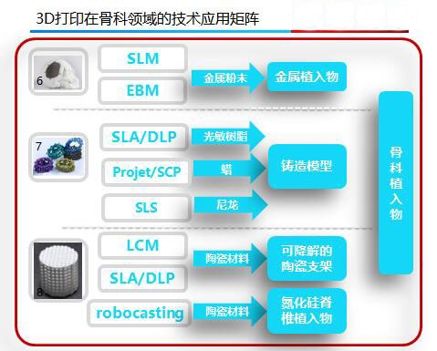 后路腰椎間融合器——Stryker的產業(yè)化之路