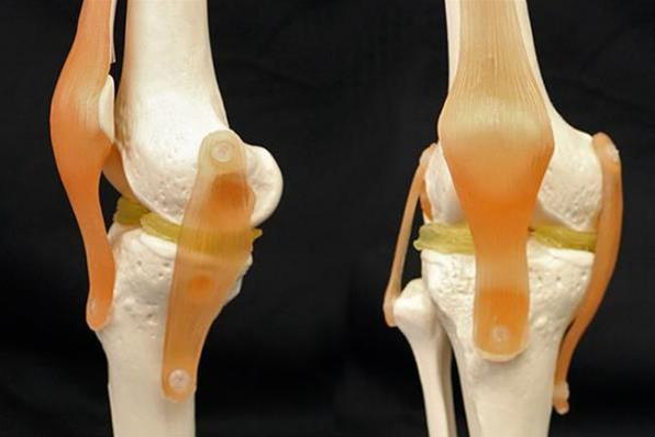 杜克大学开发出修复膝盖损伤的3D打印软骨模拟材料