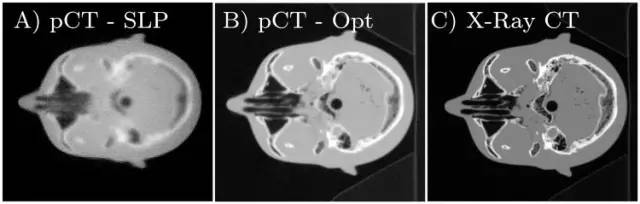 世界首台质子CT成像设备可为羊排采集质子CT图像