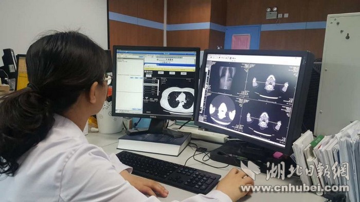 人工智能辅助CT阅片:水平接近主治医师