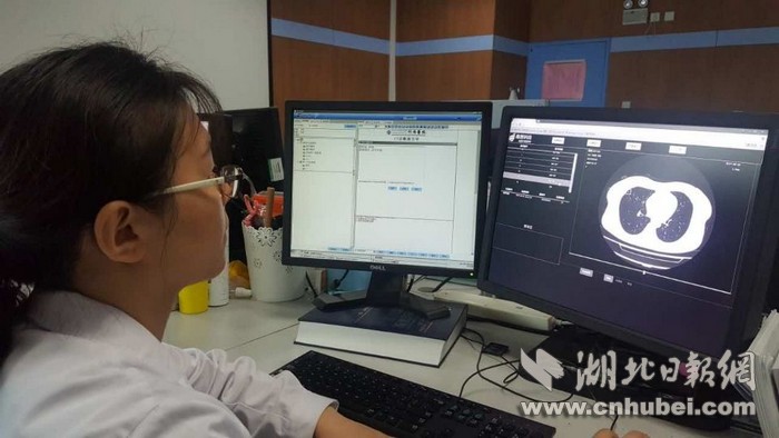 人工智能辅助CT阅片:水平接近主治医师