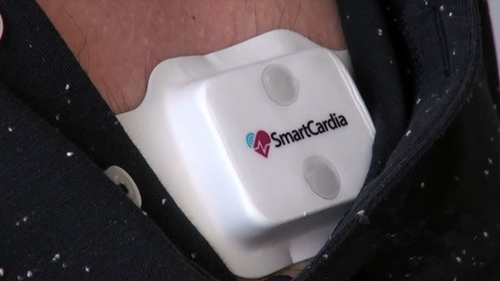 Smartcardia无线电子贴片将取代急诊监测仪器