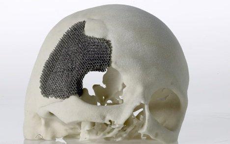 3D打印技术在生物医用材料产业应用展望