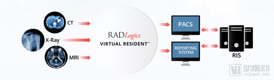 被两家亚洲集团联合收购，RADLogics的算法25秒可扫描2000张图像