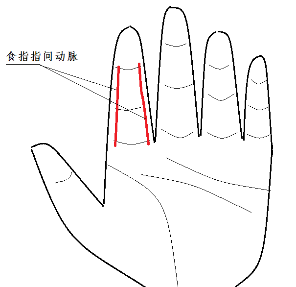 一款心率戒指的設計