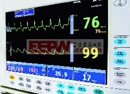 病人监护仪所显示的ECG和血氧读数